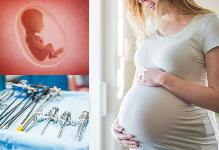 Trump ukinuo financiranje programima klinika za pobačaje ‘Planned Parenthood’ i preusmjerio sredstva centrima za zaštitu života