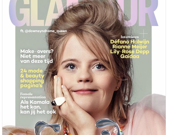 Influencerica s Downovim sindromom na naslovnici časopisa Glamour!