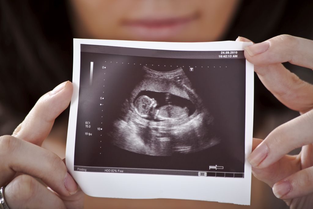 Teksas: Na snazi zabrana pobačaja nakon 6. tjedna trudnoće